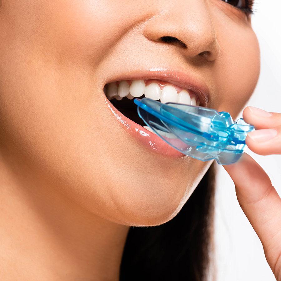 night guard for bruxism at Blue Bell Family Dentistry