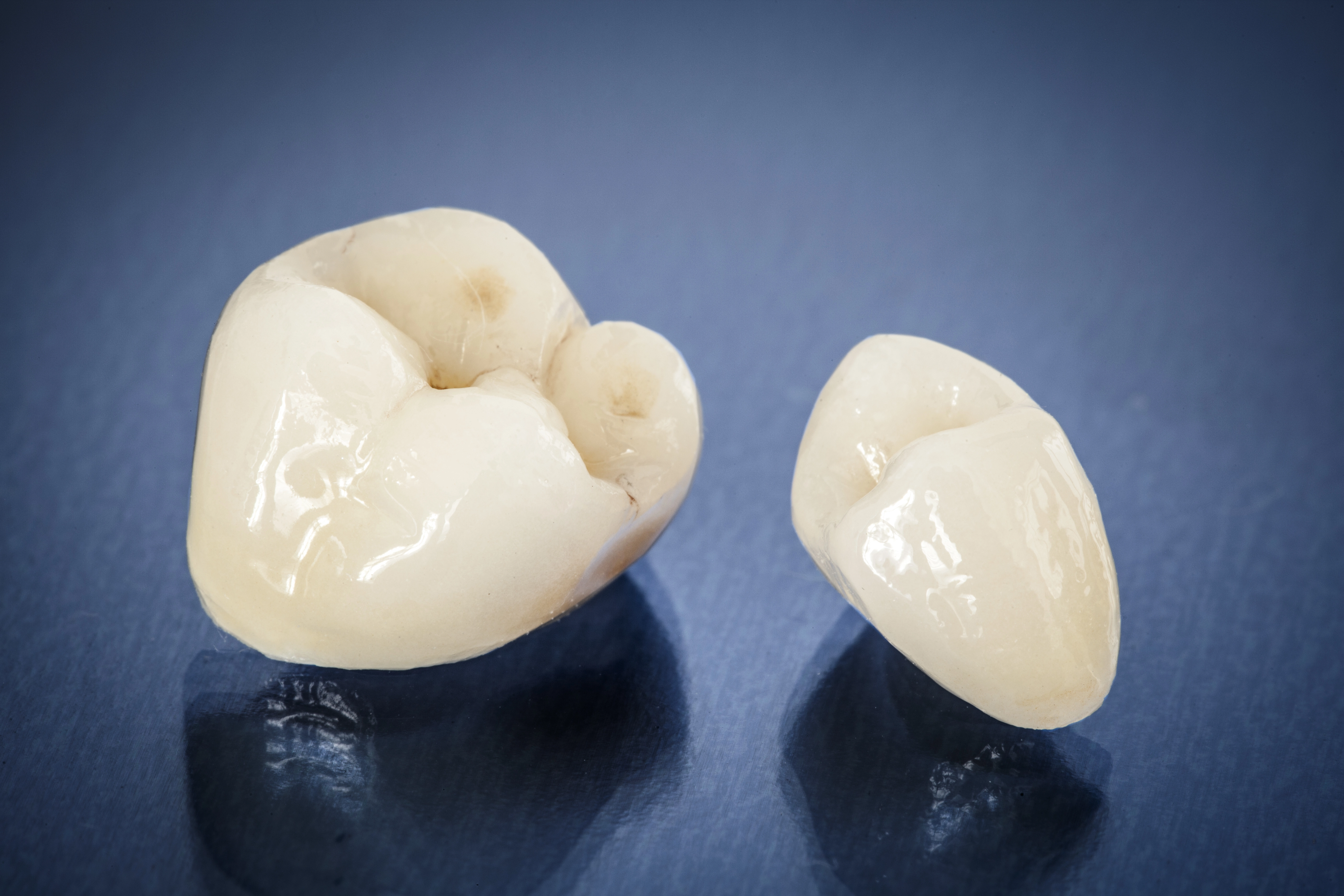 Natural-looking dental crown treatment