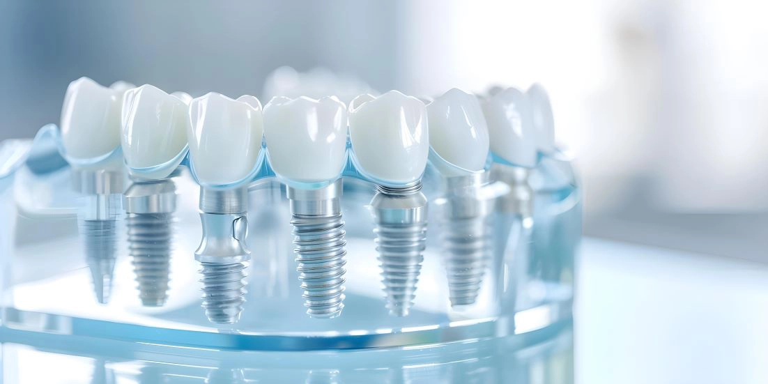 Dental implant treatment consultation